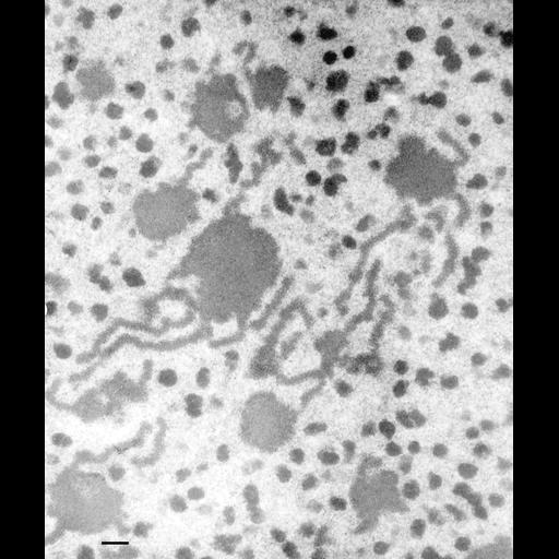  NCBI Organism:Paramecium multimicronucleatum; Cell Types:cell by organism, eukaryotic cell, , ; Cell Components:macronucleus, nucleolus; Biological process:nucleolar fragmentation involved in replicative aging, macronucleus organization;