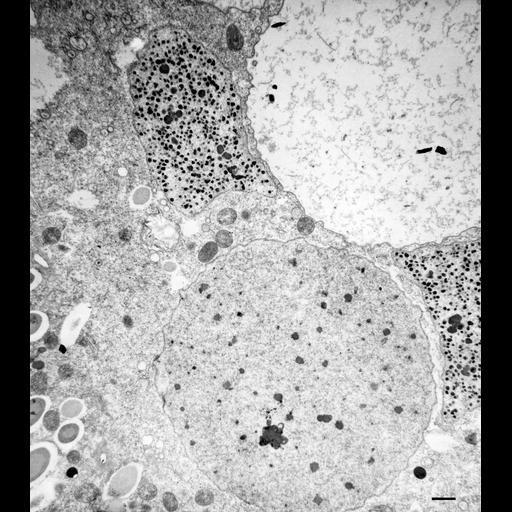  NCBI Organism:Paramecium multimicronucleatum; Cell Types:cell by organism, eukaryotic cell, , ; Cell Components:nucleolus, macronucleus; Biological process:nucleolus organization, macronucleus organization;