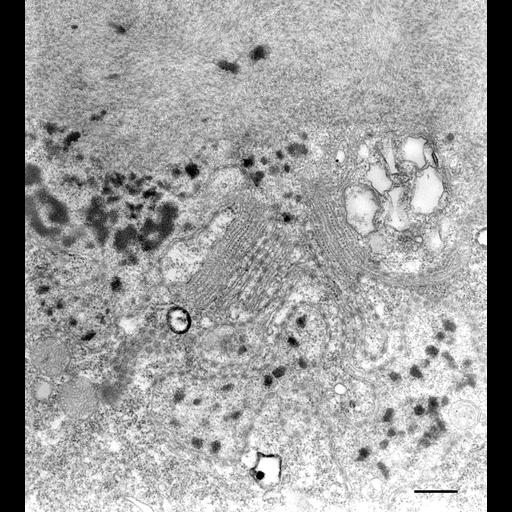  NCBI Organism:Paramecium multimicronucleatum; Cell Types:cell by organism, eukaryotic cell, , ; Cell Components:macronucleus, nuclear pore; Biological process:macronucleus organization, nuclear pore distribution;