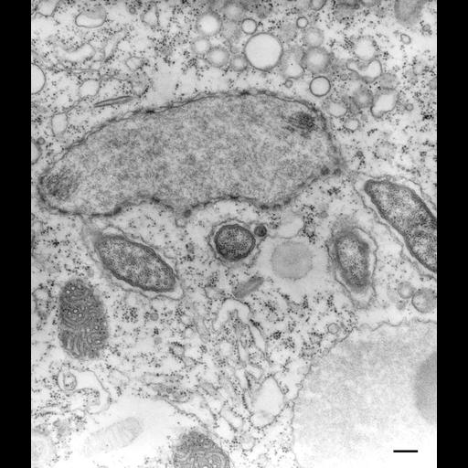  NCBI Organism:Paramecium multimicronucleatum; Cell Types:cell by organism, eukaryotic cell, , ; Cell Components:symbiont-containing vacuole membrane, micronucleus; Biological process:detection of symbiont, micronucleus organization;