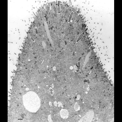  NCBI Organism:Paramecium multimicronucleatum; Cell Types:cell by organism, eukaryotic cell, , ; Cell Components:cell, cytoplasm, trichocyst; Biological process:organelle organization, ;