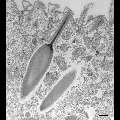  NCBI Organism:Paramecium multimicronucleatum; Cell Types:cell by organism, eukaryotic cell, , ; Cell Components:trichocyst, organelle membrane; Biological process:organelle organization, ;