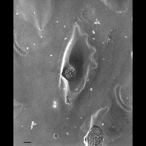  NCBI Organism:Paramecium multimicronucleatum; Cell Types:cell by organism, eukaryotic cell, , ; Cell Components:plasma membrane, trichocyst, pellicle; Biological process:plasma membrane organization