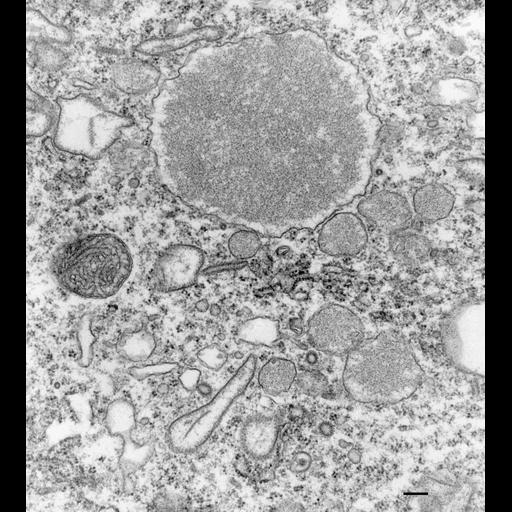  NCBI Organism:Paramecium multimicronucleatum; Cell Types:cell by organism, eukaryotic cell, , ; Cell Components:trichocyst, organelle membrane, lysosomal membrane; Biological process:organelle assembly