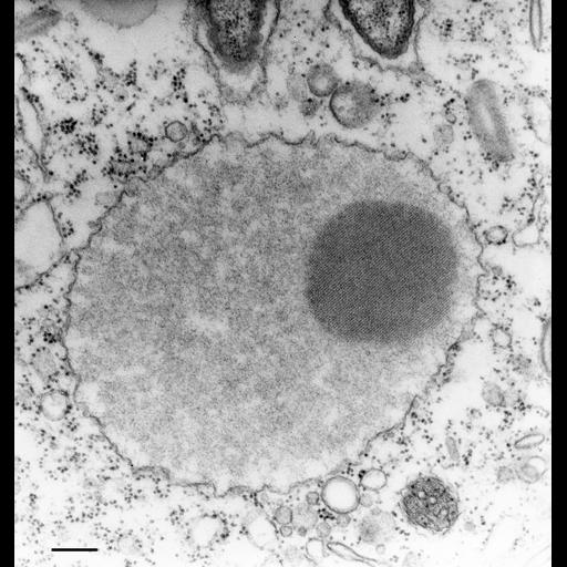  NCBI Organism:Paramecium multimicronucleatum; Cell Types:cell by organism, eukaryotic cell, , ; Cell Components:trichocyst Biological process:organelle assembly