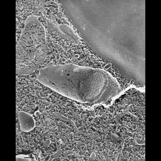  NCBI Organism:Paramecium multimicronucleatum; Cell Types:cell by organism, eukaryotic cell, , ; Cell Components:trichocyst Biological process:organelle organization