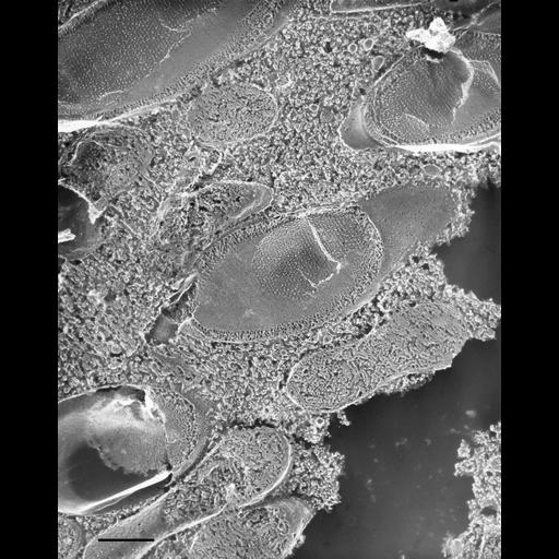  NCBI Organism:Paramecium multimicronucleatum; Cell Types:cell by organism, eukaryotic cell, , ; Cell Components:trichocyst Biological process:organelle organization