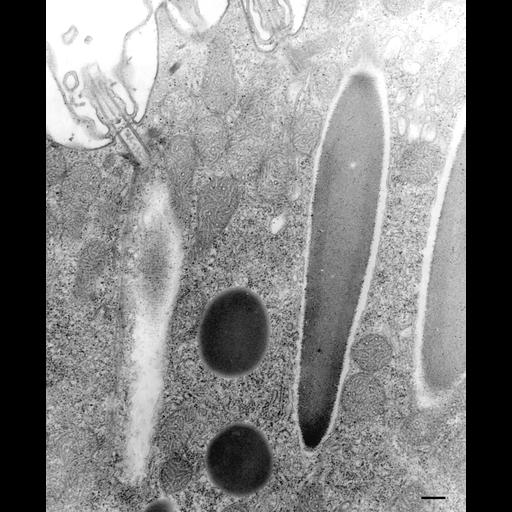  NCBI Organism:Paramecium multimicronucleatum; Cell Types:cell by organism, eukaryotic cell, , ; Cell Components:trichocyst, microtubule associated complex, cell cortex; Biological process:organelle localization, cortical cytoskeleton organization;