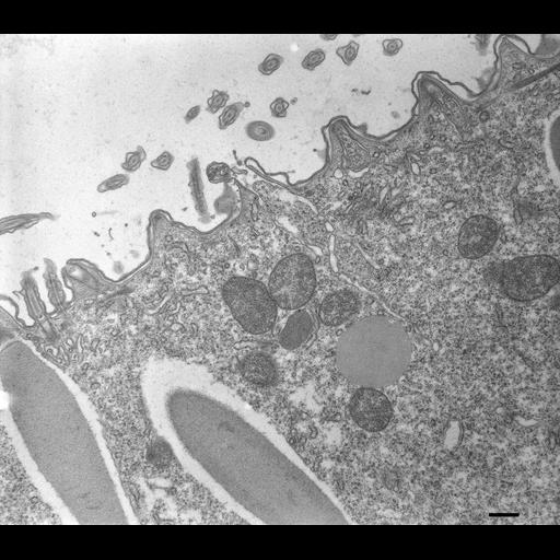  NCBI Organism:Paramecium multimicronucleatum; Cell Types:cell by organism, eukaryotic cell, , ; Cell Components:trichocyst, organelle membrane, cell cortex; Biological process:organelle localization, cortical cytoskeleton organization;