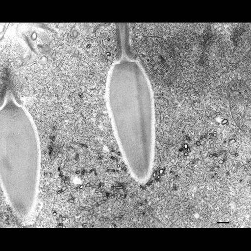  NCBI Organism:Paramecium multimicronucleatum; Cell Types:cell by organism, eukaryotic cell, , ; Cell Components:trichocyst, ; Biological process:organelle organization, ;