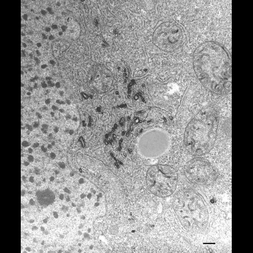  NCBI Organism:Paramecium multimicronucleatum; Cell Types:cell by organism, eukaryotic cell, , ; Cell Components:trichocyst, organelle membrane, Golgi trans cisterna; Biological process:organelle assembly