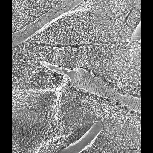  NCBI Organism:Paramecium multimicronucleatum; Cell Types:cell by organism, eukaryotic cell, , ; Cell Components:trichocyst Biological process:positive regulation of organelle organization