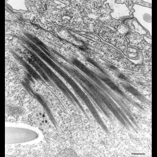  NCBI Organism:Paramecium multimicronucleatum; Cell Types:cell by organism, eukaryotic cell, , ; Cell Components:oral apparatus, microtubule associated complex, food vacuole; Biological process:oral apparatus organization, microtubule bundle formation;