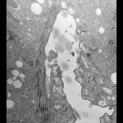  NCBI Organism:Paramecium multimicronucleatum; Cell Types:cell by organism, eukaryotic cell, , ; Cell Components:oral apparatus, food vacuole, microtubule associated complex; Biological process:oral apparatus organization, microtubule-based process, response to food, microtubule-based transport;