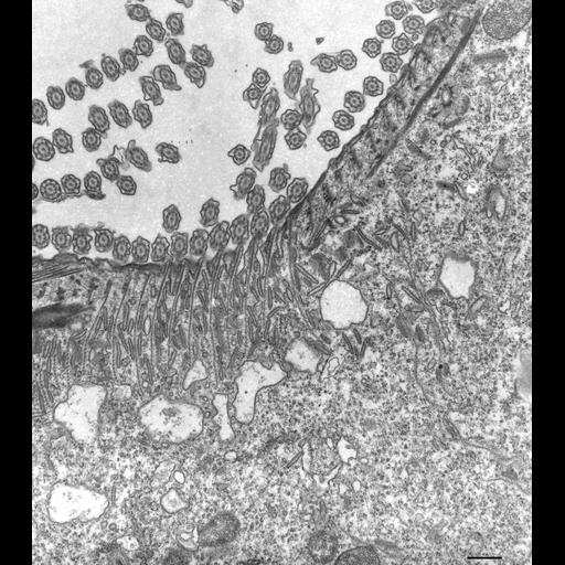  NCBI Organism:Paramecium multimicronucleatum; Cell Types:cell by organism, eukaryotic cell, , ; Cell Components:oral apparatus, cell cortex part, microtubule associated complex; Biological process:oral apparatus organization