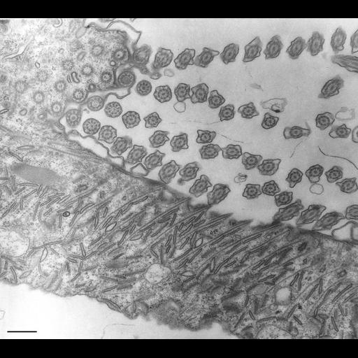  NCBI Organism:Paramecium multimicronucleatum; Cell Types:cell by organism, eukaryotic cell, , ; Cell Components:oral apparatus, microtubule associated complex; Biological process:oral apparatus organization