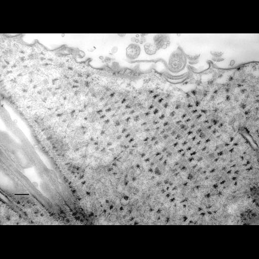  NCBI Organism:Paramecium multimicronucleatum; Cell Types:cell by organism, eukaryotic cell, , ; Cell Components:oral apparatus Biological process:oral apparatus organization