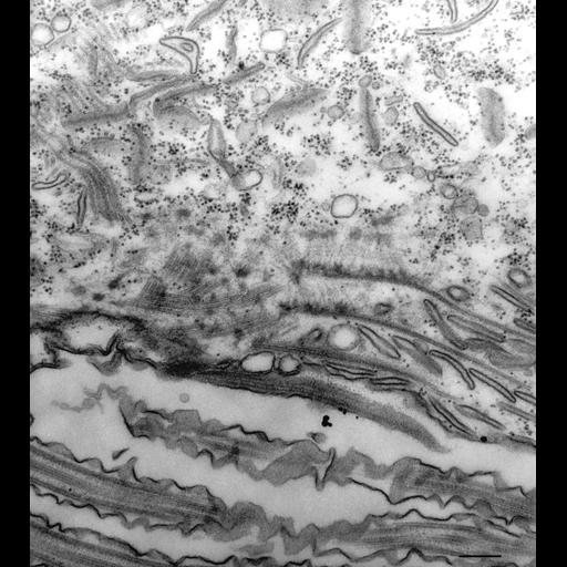  NCBI Organism:Paramecium multimicronucleatum; Cell Types:cell by organism, eukaryotic cell, , ; Cell Components:oral apparatus, microtubule associated complex; Biological process:oral apparatus organization