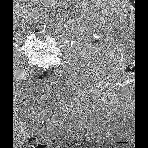  NCBI Organism:Paramecium multimicronucleatum; Cell Types:cell by organism, eukaryotic cell, , ; Cell Components:oral apparatus, early endosome membrane, microtubule associated complex, food vacuole; Biological process:oral apparatus organization, endosome organization;