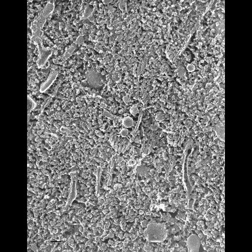  NCBI Organism:Paramecium multimicronucleatum; Cell Types:cell by organism, eukaryotic cell, , ; Cell Components:transport vesicle, microtubule associated complex, cytoplasmic dynein complex; Biological process:cytoplasmic microtubule organization, vesicle docking involved in exocytosis;