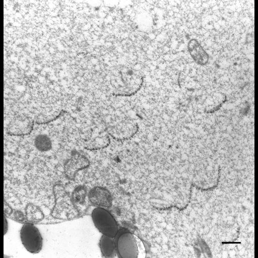  NCBI Organism:Paramecium multimicronucleatum; Cell Types:cell by organism, eukaryotic cell, , ; Cell Components:microtubule associated complex, oral apparatus; Biological process:microtubule cytoskeleton organization, oral apparatus organization;