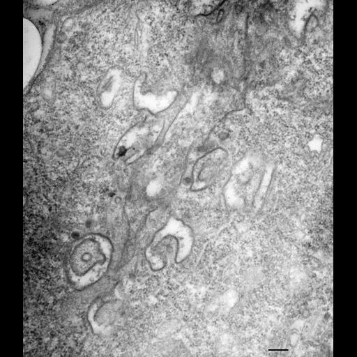  NCBI Organism:Paramecium multimicronucleatum; Cell Types:cell by organism, eukaryotic cell, , ; Cell Components:endocytic vesicle lumen, vesicle membrane, early endosome; Biological process:digestive system process