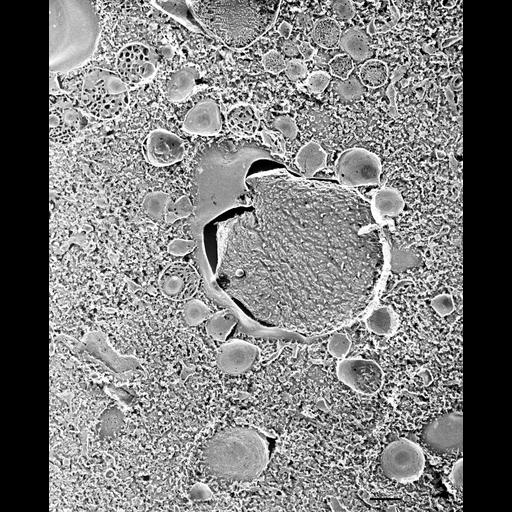  NCBI Organism:Paramecium multimicronucleatum; Cell Types:cell by organism, eukaryotic cell, , ; Cell Components:vesicle membrane, early phagosome, trichocyst; Biological process:vesicle fusion, phagosome acidification;