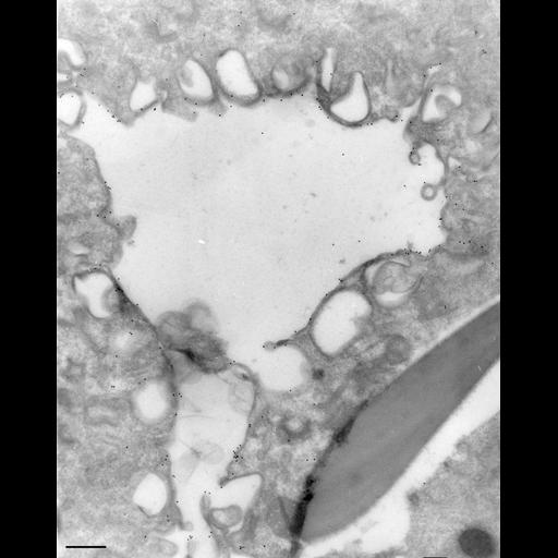  NCBI Organism:Paramecium multimicronucleatum; Cell Types:cell by organism, eukaryotic cell, , ; Cell Components:pre-autophagosomal structure membrane, , vesicle membrane; Biological process:digestive system process