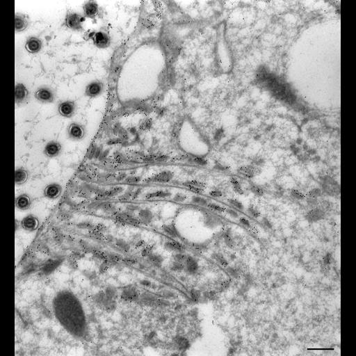  NCBI Organism:Paramecium multimicronucleatum; Cell Types:cell by organism, eukaryotic cell, , ; Cell Components:early phagosome, food vacuole, vesicle membrane; Biological process:digestive system process