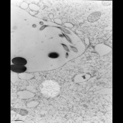  NCBI Organism:Paramecium multimicronucleatum; Cell Types:cell by organism, eukaryotic cell, , ; Cell Components:food vacuole, early phagosome; Biological process:digestive system process