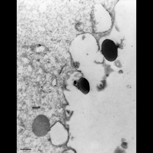  NCBI Organism:Paramecium multimicronucleatum; Cell Types:cell by organism, eukaryotic cell, , ; Cell Components:food vacuole, early phagosome; Biological process:digestive system process