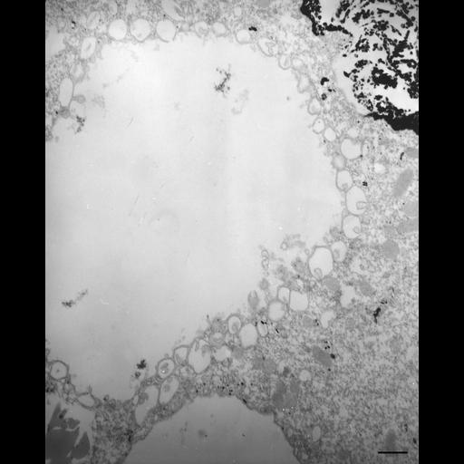  NCBI Organism:Paramecium multimicronucleatum; Cell Types:cell by organism, eukaryotic cell, , ; Cell Components:early phagosome, lysosome, transport vesicle, ; Biological process:digestive system process