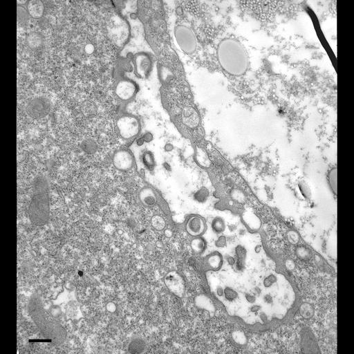  NCBI Organism:Paramecium multimicronucleatum; Cell Types:cell by organism, eukaryotic cell, , ; Cell Components:early phagosome, lysosome, food vacuole; Biological process:digestive system process