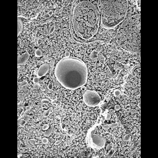  NCBI Organism:Paramecium multimicronucleatum; Cell Types:cell by organism, eukaryotic cell, , ; Cell Components:early phagosome, vesicle membrane, phagolysosome; Biological process:digestive system process