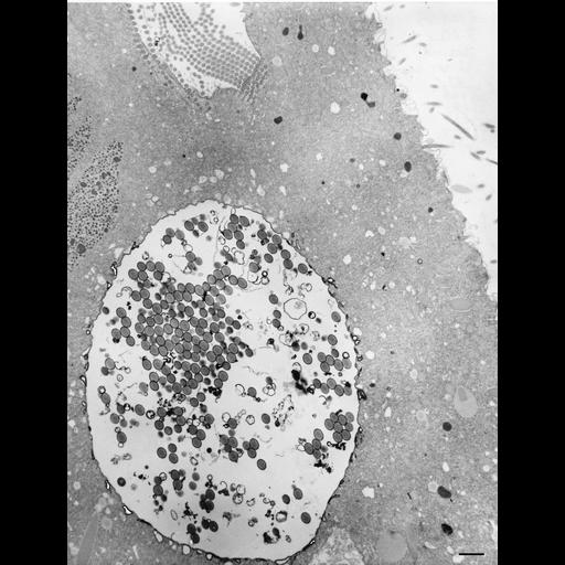  NCBI Organism:Paramecium multimicronucleatum; Cell Types:cell by organism, eukaryotic cell, , ; Cell Components:, lysosome; Biological process:response to drug, digestive system process;