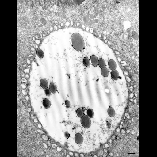  NCBI Organism:Paramecium multimicronucleatum; Cell Types:cell by organism, eukaryotic cell, , ; Cell Components:food vacuole, secondary lysosome; Biological process:digestive system process