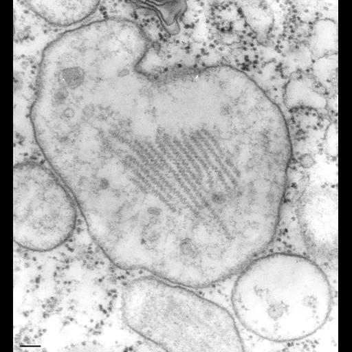  NCBI Organism:Paramecium multimicronucleatum; Cell Types:cell by organism, eukaryotic cell, , ; Cell Components:lysosome, primary lysosome; Biological process:digestive system process