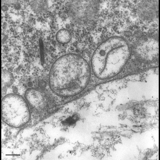  NCBI Organism:Paramecium multimicronucleatum; Cell Types:cell by organism, eukaryotic cell, , ; Cell Components:, , primary lysosome; Biological process:digestive system process