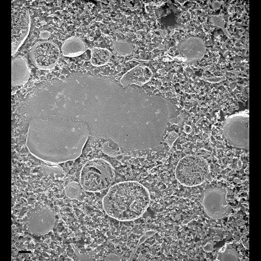  NCBI Organism:Paramecium multimicronucleatum; Cell Types:cell by organism, eukaryotic cell, , ; Cell Components:secondary lysosome, cytoplasm; Biological process:digestive system process, cytoplasm organization;