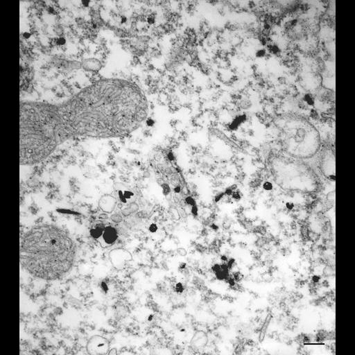  NCBI Organism:Paramecium multimicronucleatum; Cell Types:cell by organism, eukaryotic cell, , ; Cell Components:primary lysosome, Golgi stack, endoplasmic reticulum; Biological process:protein targeting to Golgi, ;