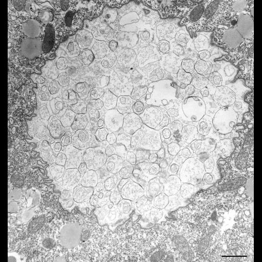  NCBI Organism:Paramecium multimicronucleatum; Cell Types:cell by organism, eukaryotic cell, , ; Cell Components:phagolysosome, food vacuole; Biological process:digestive system process