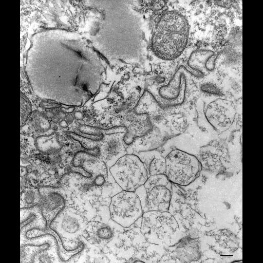  NCBI Organism:Paramecium multimicronucleatum; Cell Types:cell by organism, eukaryotic cell, , ; Cell Components:phagolysosome Biological process:digestive system process