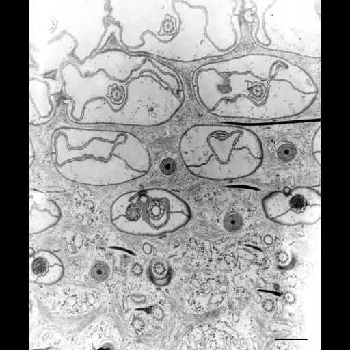  NCBI Organism:Paramecium caudatum; Cell Types:cell by organism, eukaryotic cell, , ; Cell Components:cell cortex, , cortical cytoskeleton, cilium, microtubule basal body; Biological process:plasma membrane organization, cortical cytoskeleton organization;