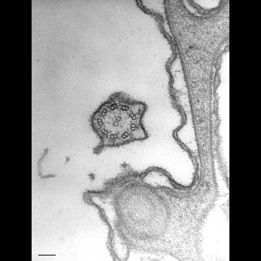  NCBI Organism:Paramecium caudatum; Cell Types:cell by organism, eukaryotic cell, , ; Cell Components:cilium, trichocyst, pellicle; Biological process:, cortical cytoskeleton organization;