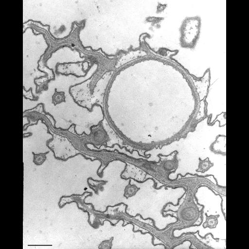  NCBI Organism:Paramecium caudatum; Cell Types:cell by organism, eukaryotic cell, , ; Cell Components:contractile vacuole pore, microtubule associated complex, , cell cortex; Biological process:contractile vacuole organization, cortical cytoskeleton organization;