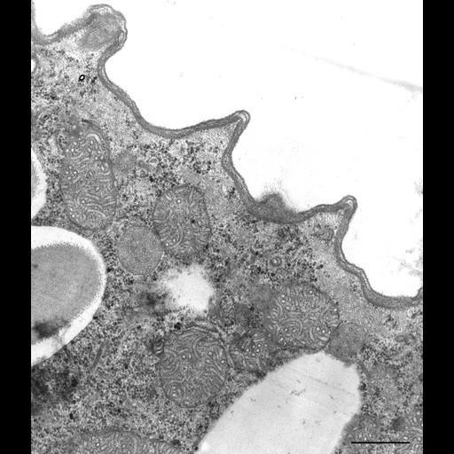  NCBI Organism:Paramecium caudatum; Cell Types:cell by organism, eukaryotic cell, , ; Cell Components:cytoplasm, pellicle, plasma membrane, cell cortex; Biological process:plasma membrane organization, cytoplasm organization, organelle organization;