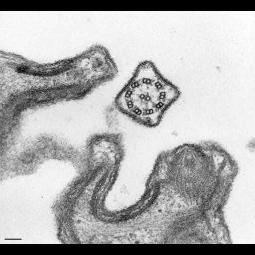  NCBI Organism:Paramecium caudatum; Cell Types:cell by organism, eukaryotic cell, , ; Cell Components:cilium, glycocalyx; Biological process:ciliary or flagellar motility, plasma membrane organization;