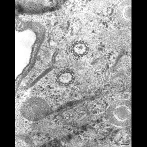  NCBI Organism:Paramecium caudatum; Cell Types:cell by organism, eukaryotic cell, , ; Cell Components:microtubule basal body, ; Biological process:microtubule basal body organization, microtubule cytoskeleton organization;