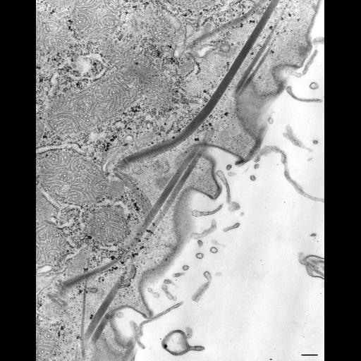  NCBI Organism:Paramecium caudatum; Cell Types:cell by organism, eukaryotic cell, , ; Cell Components:cortical microtubule cytoskeleton, , ; Biological process:cortical cytoskeleton organization