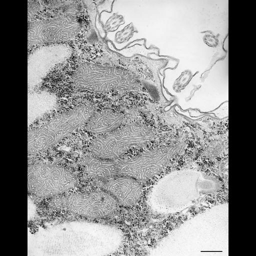  NCBI Organism:Paramecium caudatum; Cell Types:cell by organism, eukaryotic cell, , ; Cell Components:coated pit, cell cortex, mitochondrion, glycogen granule; Biological process:cortical cytoskeleton organization, cytoplasm organization;